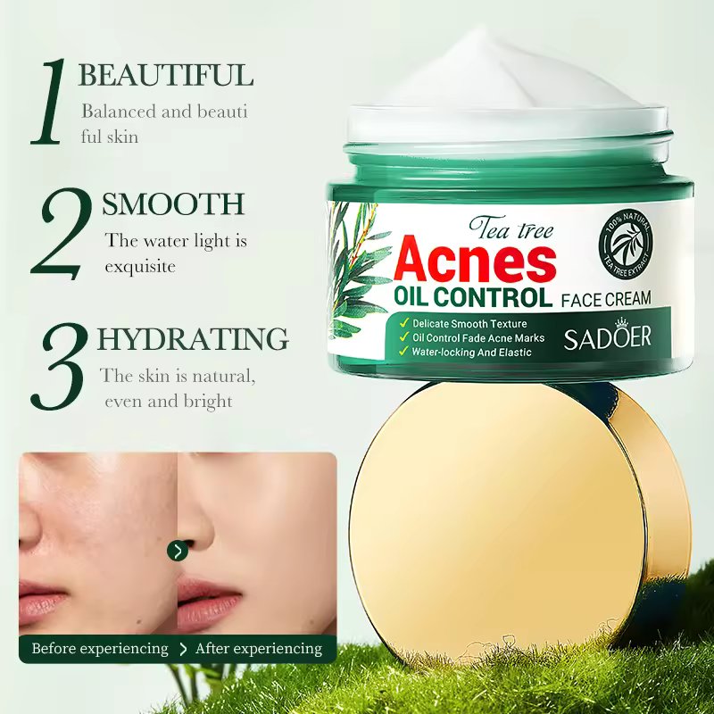 Acne Oil Control Face Cream |Pimple Remover Cream, Get Rid of Pimples Fast for Oily and Acne Prone Skin, Cruelty Free- 50g